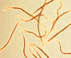 Banner Content Image: https://www.ctsgardensupplies.co.uk/images/banner/source/beneficial-nematodes.gA1E68IuHJ.jpg?t=1789136466